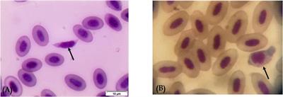 First microscopic, pathological, epidemiological, and molecular investigation of Leucocytozoon (Apicomplexa: Haemosporida) parasites in Egyptian pigeons